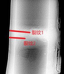 極X射線檢測系統(tǒng)